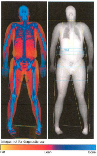 Image of diagnostic use